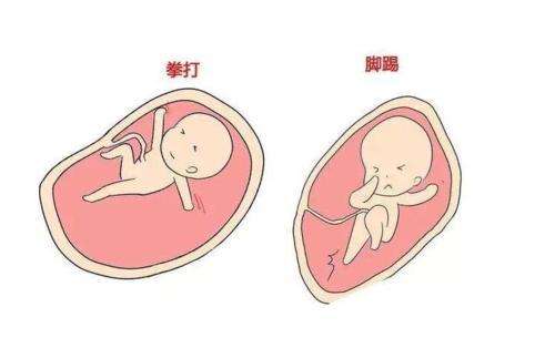 孕妇防辐射服哪个牌子好最受孕妈咪喜爱的3个牌子