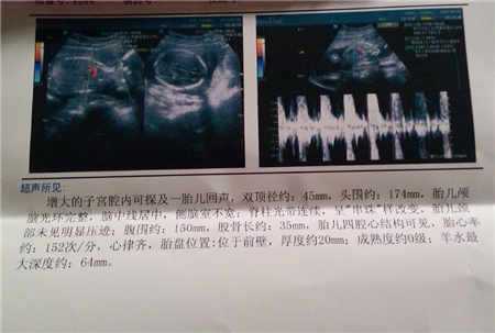北京代孕日期测男孩女孩准确率99%？