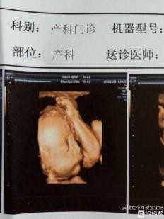 广州代孕什么价位：男性如何预防精子不液化